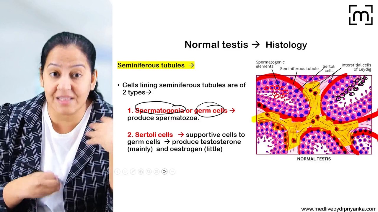 1. Cryptorchidism