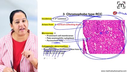 10. Tumors of Kidney