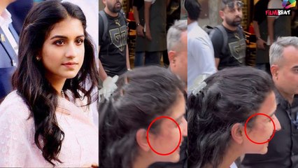Radhika Ambani Face : Ambani Family की बहू राधिका के चेहरे पर निशान, चौंके Fans, किए ऐसे कमेंट्स