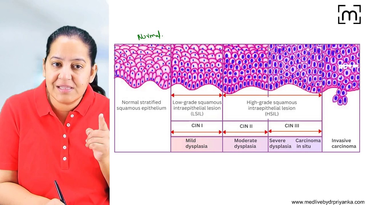 1. Cervical Precancers