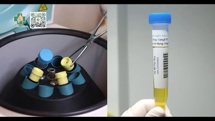 Tiêm huyết tương giàu tiểu cầu PRP giá bao nhiêu?