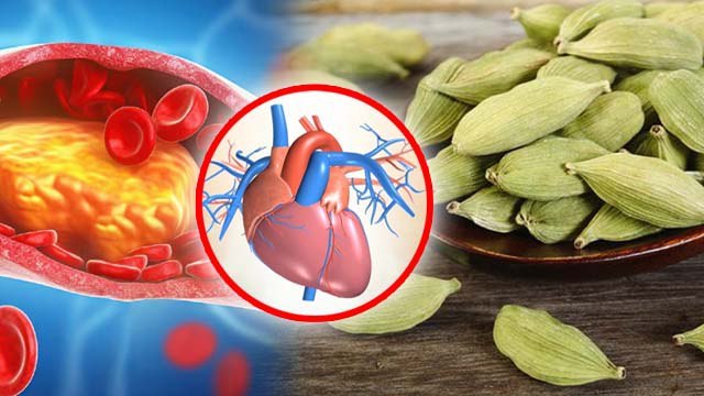 Cardamom In High Cholesterol:हाई कोलेस्ट्रॉल में इलायची खाने के फायदे, Benefits In Hindi | Boldsky