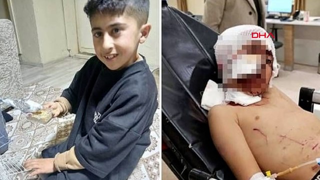 Bakkala giderken köpeklerin saldırısına uğrayan Murat, ağır yaralandı