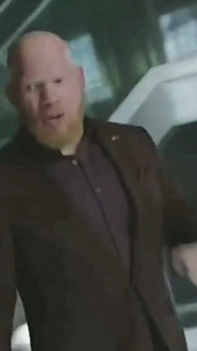 Tobial l’albinos le plus booste de l’histoire