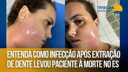 Entenda como infecção após extração de dente levou paciente à morte no ES