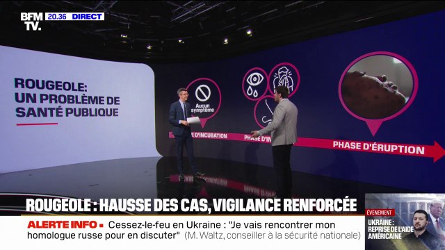 Hausse des cas de rougeole: un problème de santé publique