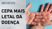 Ministério da Saúde envia equipe para monitorar caso de Mpox em SP