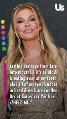 Brandi Glanville’s Facial Disfigurement Is Starting to Affect Her Teeth