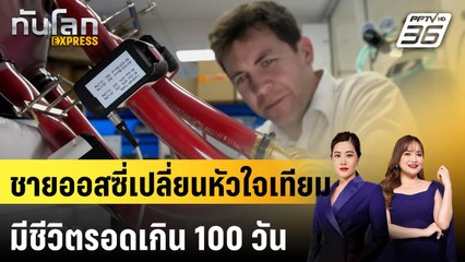 ชายออสซี่เปลี่ยนหัวใจเทียม มีชีวิตรอดเกิน 100 วัน|ทันโลก EXPRESS | 13 มี.ค. 68