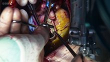 Surgeons: At the Edge of Life episode 9