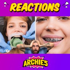 Turning Teeth into Art? The Dudes REACT to DIY Custom Grills!