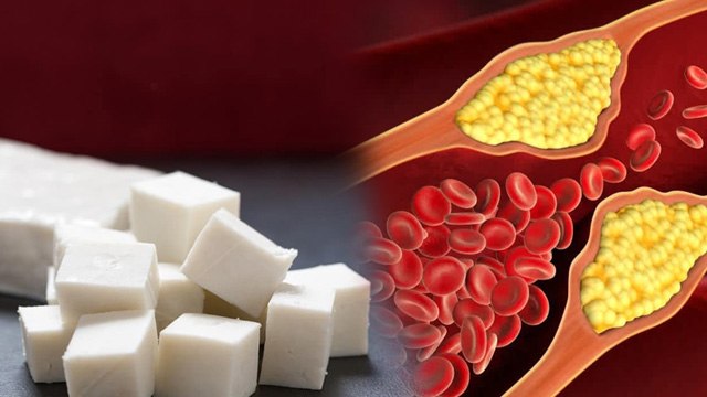 Paneer In High cholesterol:हाई कोलेस्ट्रॉल में पनीर खाने से क्या होता है,खाना चाहिए या नहीं |Boldsky