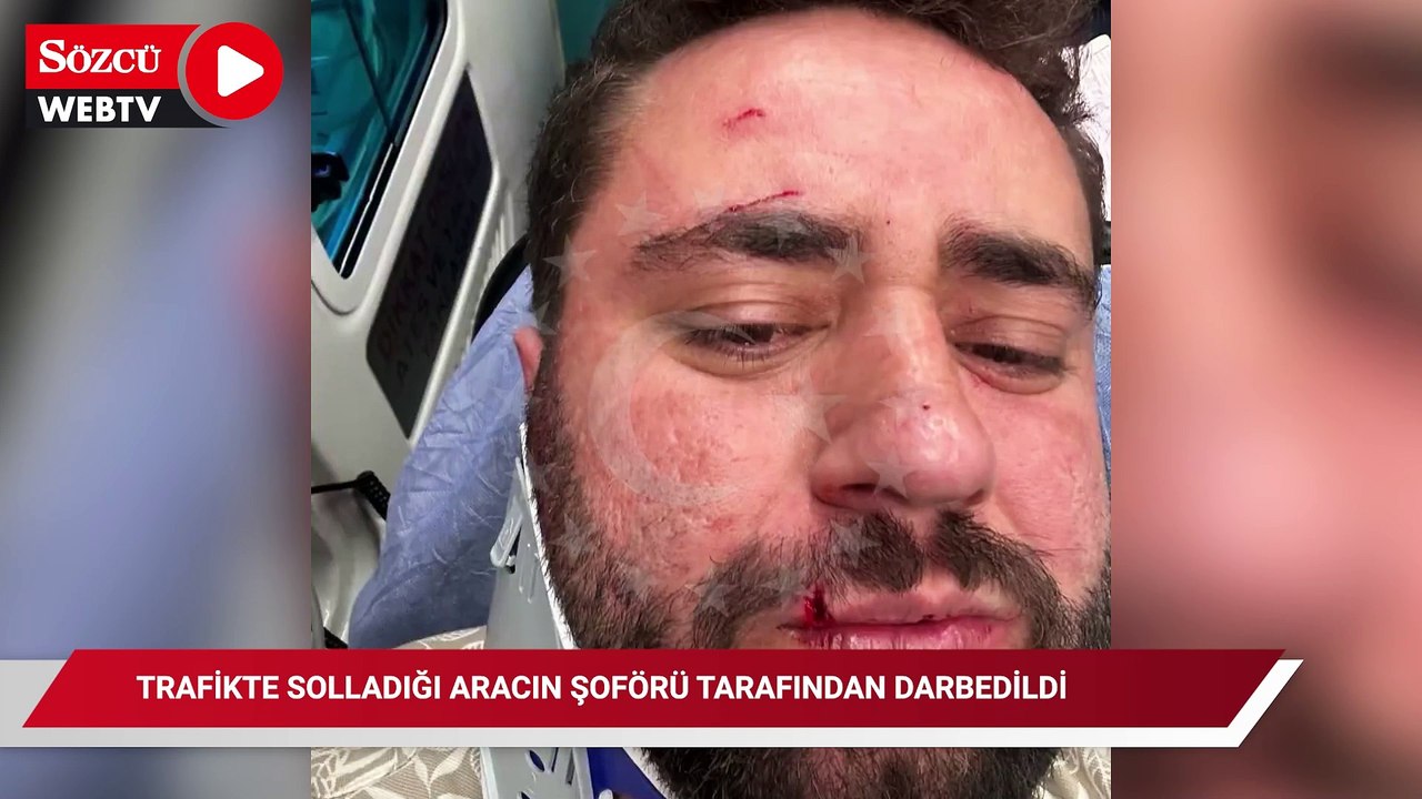 Trafikte solladığı aracın şoförü tarafından darbedildi