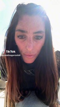 Catalina Gorostidi hizo un fuerte descargo tras recibir muchos mensajes hablando de lo delgada que está y explicó que tiene...Mirala. 