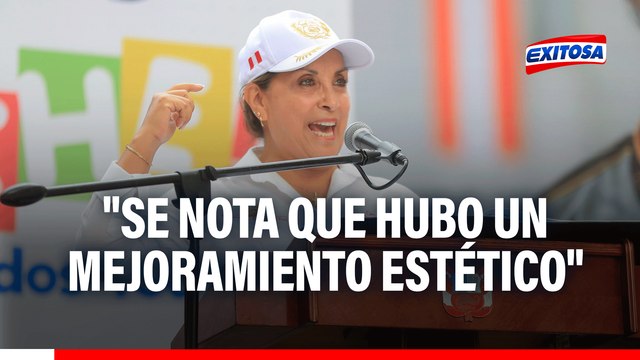 Retoque estético de Dina Boluarte es evidente, asegura cirujano: Hubo levantamiento de punta nasal