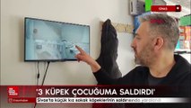 Sivas'ta küçük kız sokak köpeklerinin saldırısında yaralandı