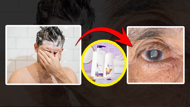 Shampoo Cause Eye Cancer: Aankhon Me Shampoo Chala Jaye To Kya Jaye To Kya Kare, Eye Care Tips