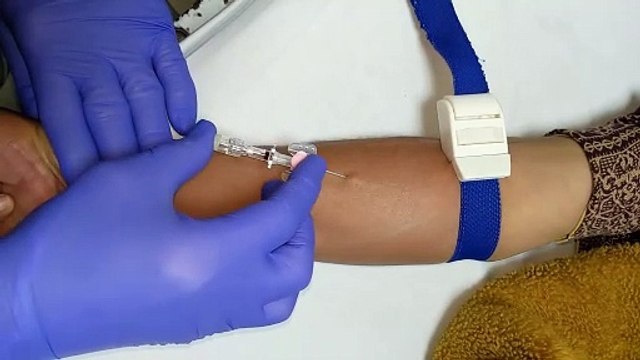 Intravenous cannula insertion techniques