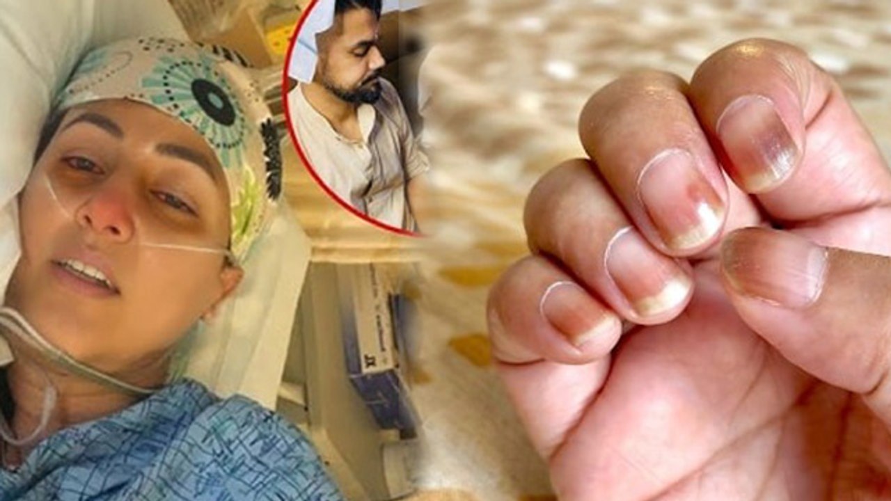 Hina Khan Chemotherapy के बाद Nail Side Effects Reason बताते  Emotional Post Viral, Fans हुए Sad