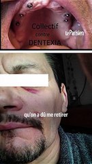 Philippe, victime d'un centre dentaire low-cost Dentexia