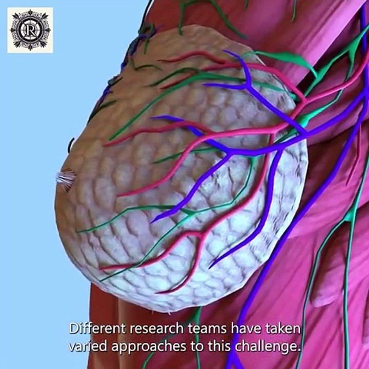 5 Years Early AI's Breakthrough in Breast Cancer Detection