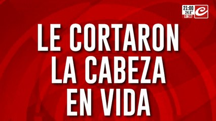 Horrible Descubrimiento: Cabeza Humana Encontrada en una Mochila 🩸
