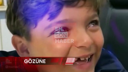 Kaybettiği gözüne kulüp armasını taktıran Anthony'nin Santos heyetiyle Curitiba gezisi