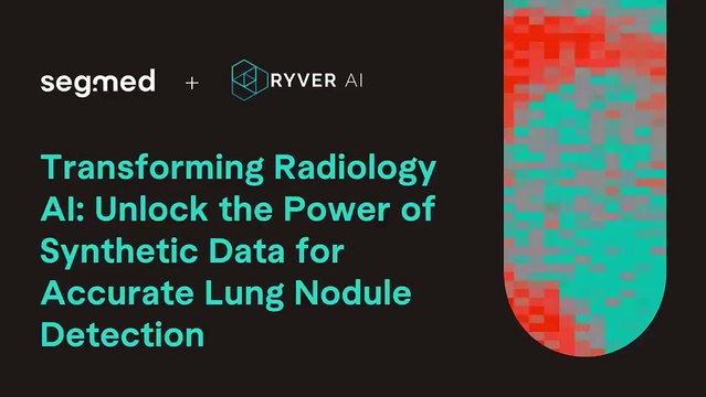 Transforming Radiology AI: Unlock the Power of Synthetic Data for Accurate Lung Nodule Detection