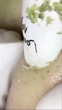 Relaxing Facial ASMR - Soothing Blackhead Removal & Skincare