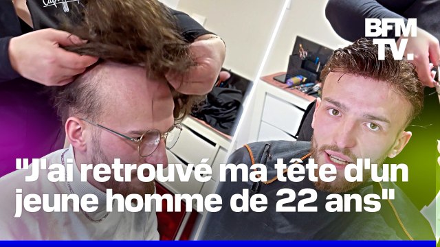 Ça vaut le prix : contre la calvitie, Jules a décidé d'opter pour les compléments capillaires