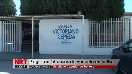 Registran 15 casos de varicela en la Esc. “Victoriano Cepeda” de Frontera