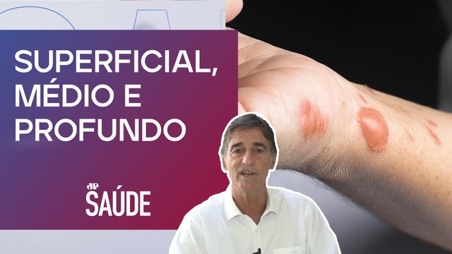 Quais riscos das queimaduras em segundo grau? | Dr. Juvenal