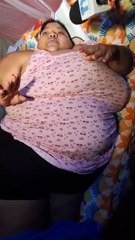 Yulexi Quevedo Pérez enfrenta grave situación de salud y solicita ayuda para costear cirugía bariátrica