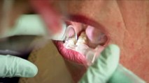 Calls for free dental care for seniors as hospitalisations surge