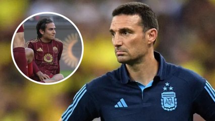 Lionel Scaloni y la baja de Dybala por una lesión muscular: "Nos duele"