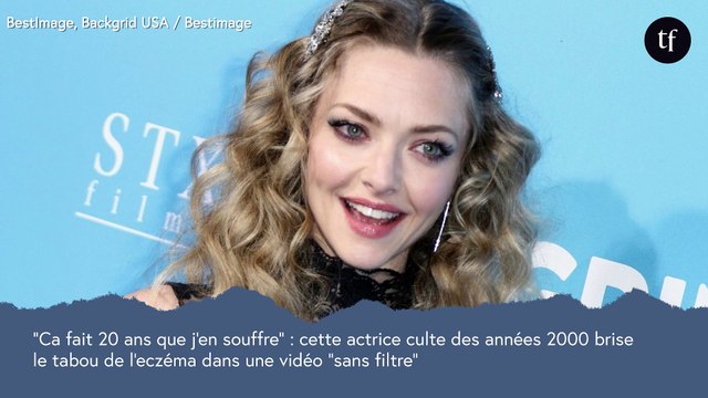 Ca fait 20 ans que j'en souffre : cette actrice culte des années 2000 brise le tabou de l'eczéma dans une vidéo sans filtre