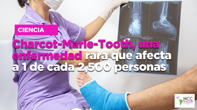 Charcot-Marie-Tooth, una enfermedad rara que afecta a 1 de cada 2,500 personas
