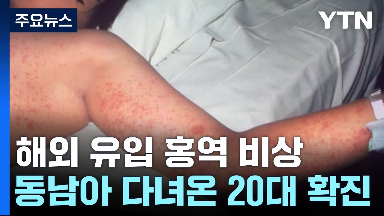 해외 유입 홍역 환자 잇따라...홍역 유행 국가 주의 / YTN