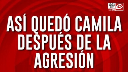 Así quedó Camila después de la agresión