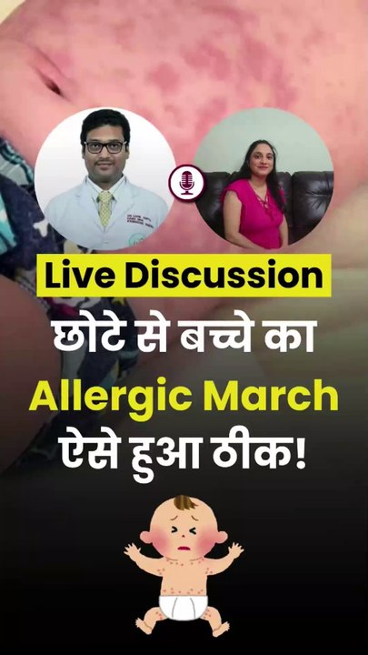 How Child From Canada Recovering from Allergic March? Live Discussion