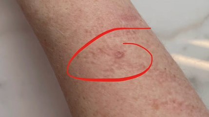 Comedian Katherine Ryan tells fans about her second cancer diagnosis