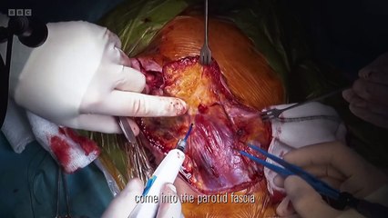 Surgeons: At the Edge of Life episode 10