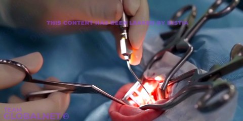 32. Facial nerve part 1