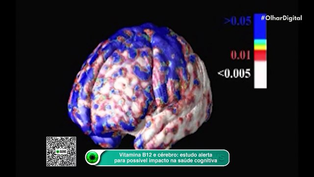 Vitamina B12 e cérebro estudo alerta para possível impacto na saúde cognitiva