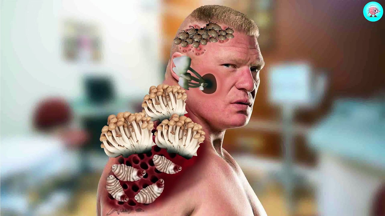 19. ASMR Brock Lesnar Face Clean   ASMR maggot removal   Deep Cleaning Animation   ASMR worm removal