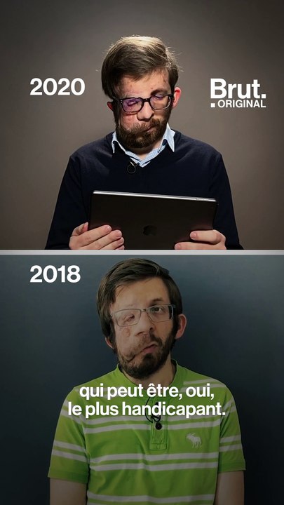 Deux ans après - Guilhem, atteint de neurofibromatose