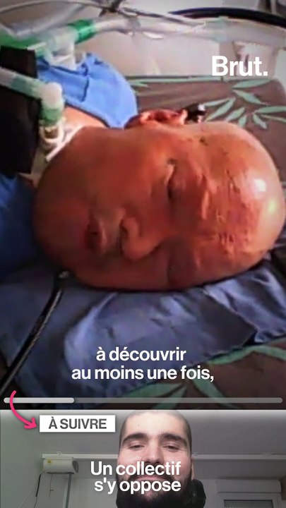 Assistants sexuels : le gouvernement ouvre le débat