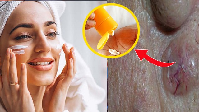 Sunscreen Side Effect On Skin:सनस्क्रीन लगाते वक्त 1 गलती,Skin Rashes से लेकर Cancer का खतरा
