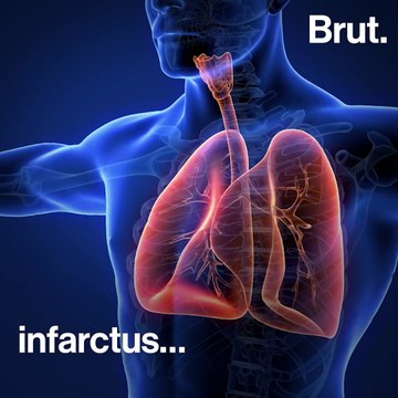 3 conséquences de la pollution aux particules fines à Paris