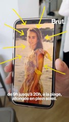 Elle ne peut plus s'exposer au soleil